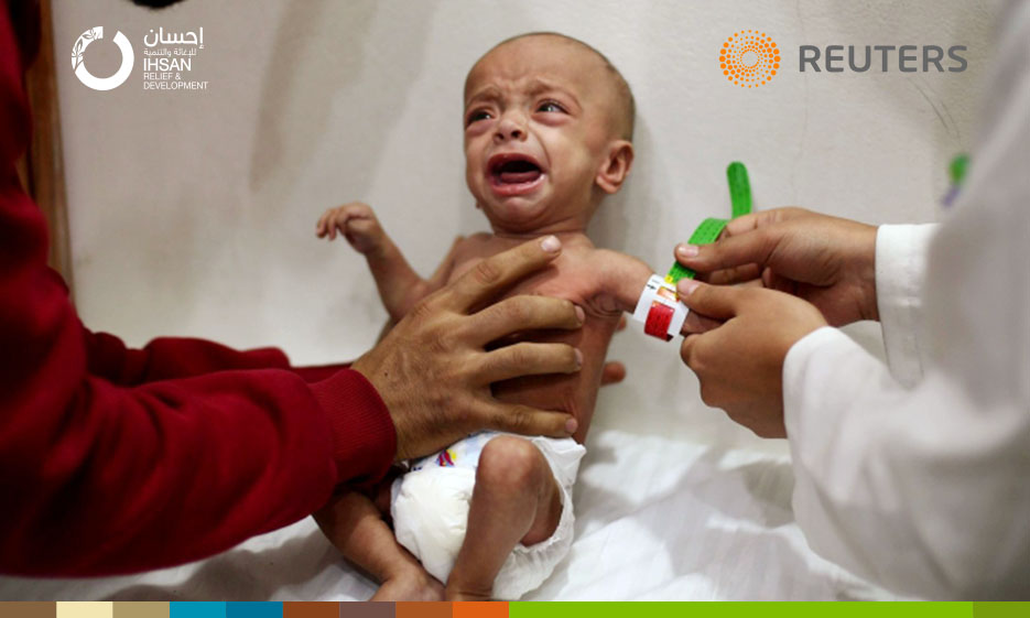 حسب منظمة الصحة العالمية 480 حالة بحاجة إلى إخلاء طبي من الغوطة حيث أعلى معدل لسوء التغذية في سوريا